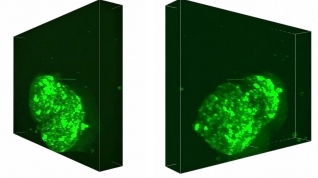 EZ LNP_mRNA delivery in 3D spheroids